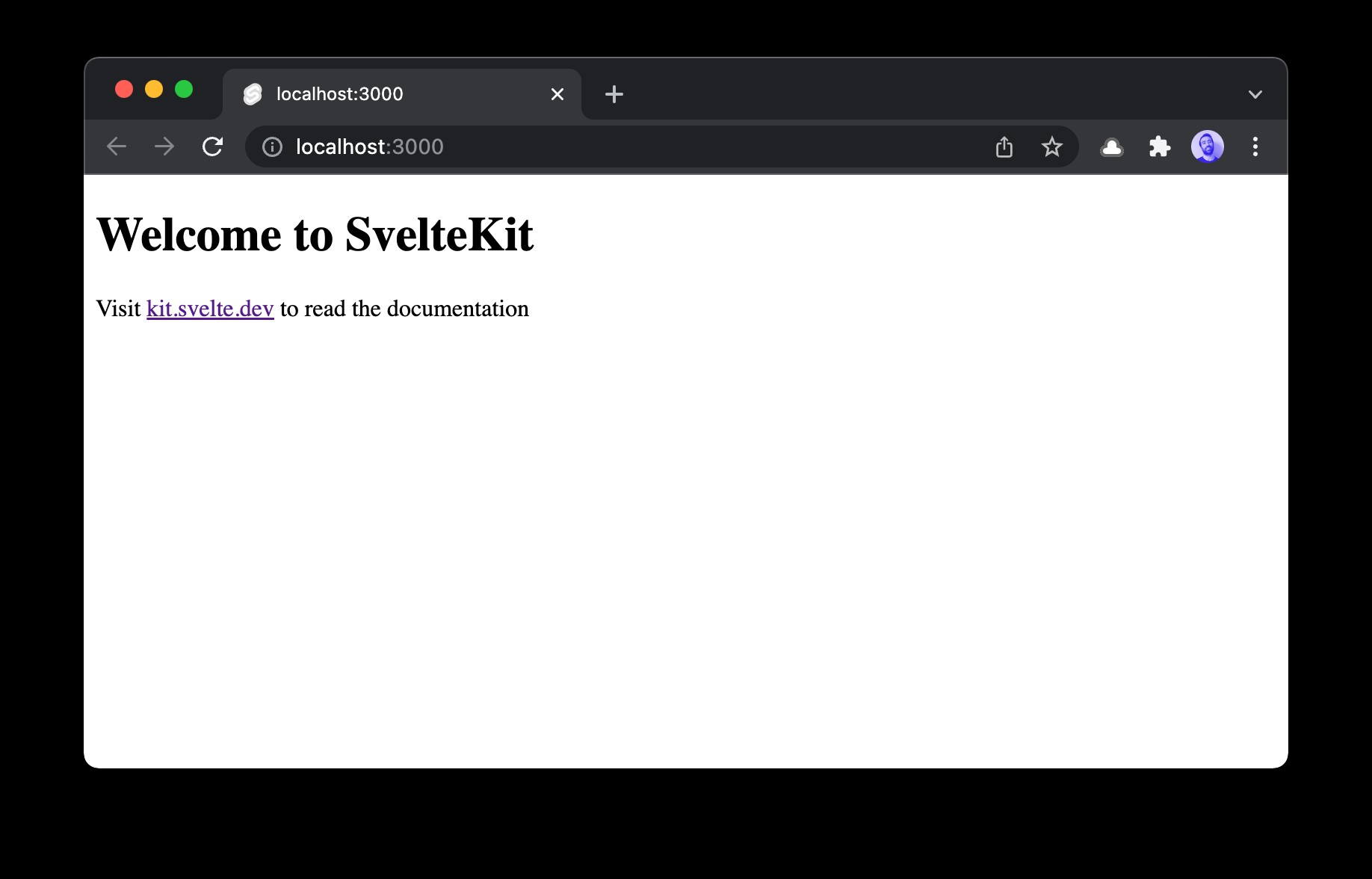 Redis সহ SvelteKit TODO অ্যাপ 